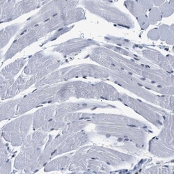 SSBIP1/SOSS-C Antibody, Novus Biologicals:Antibodies:Primary Antibodies